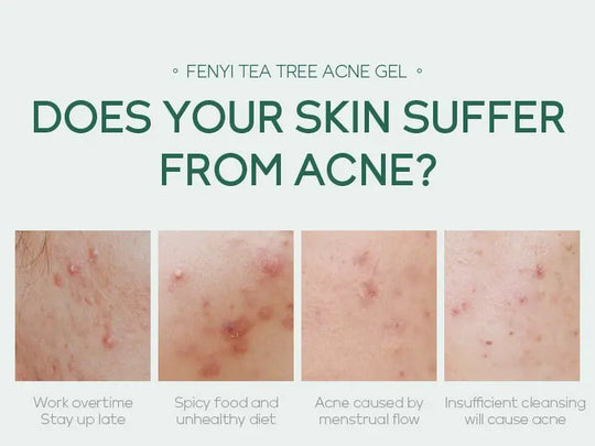 20g Moisturizing Skin Care Products - Unique Unique Unique 20g Moisturizing Skin Care Products