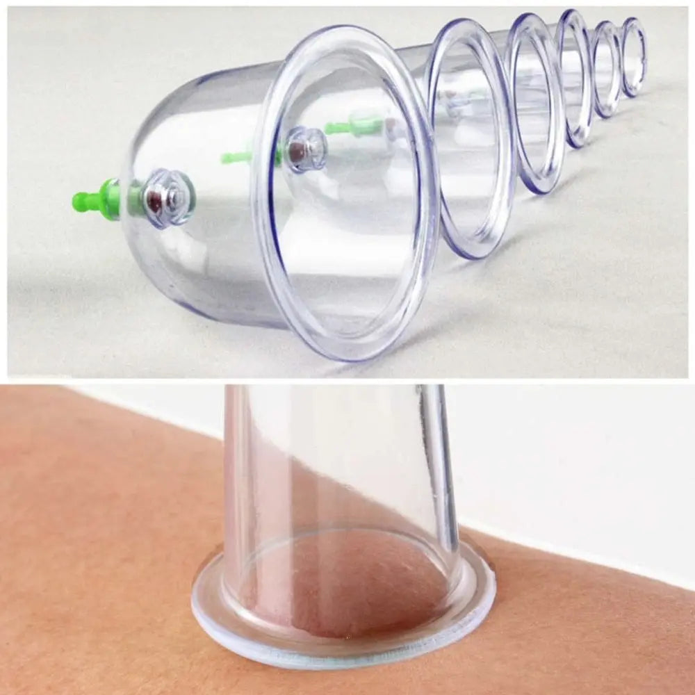 Chinese Great Medical Body Healthy Care 12Cups Kit Cupping Therapy Cups Hot Selling - Unique Unique Unique Chinese Great Medical Body Healthy Care 12Cups Kit Cupping Therapy Cups Hot Selling