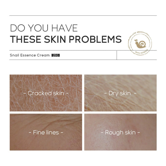 Moisturizing Skin Care Products Laikou Snail Cream - Unique Unique Unique Moisturizing Skin Care Products Laikou Snail Cream