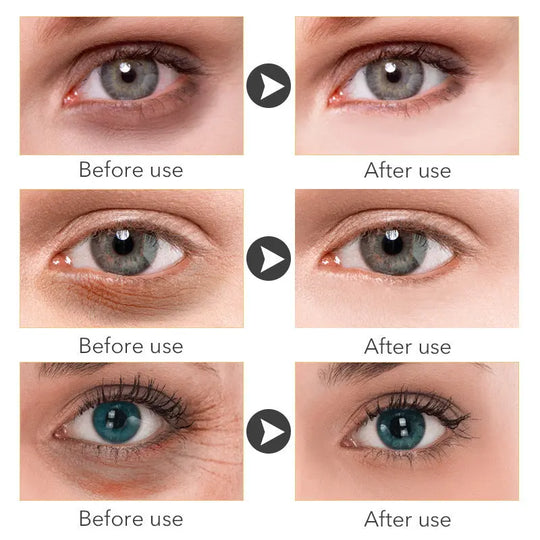 Beauty Eye Cream30mlwish Women's Skin Care Products - Unique Unique Unique Beauty Eye Cream30mlwish Women's Skin Care Products